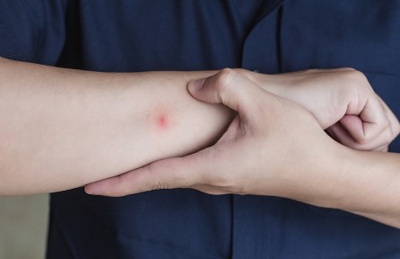 科普 | 人體是如何招致蚊子叮咬的，如何減少被叮咬？