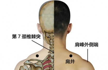 ?健康問答 | 緩解頸椎“職業(yè)病”，如何進(jìn)行中醫(yī)調(diào)理？
