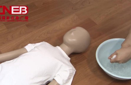 兒童燙傷時的應(yīng)急措施