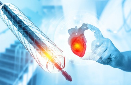 科技名詞 | 形狀記憶聚合物  shape memory polymers，SMP