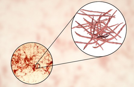 科技名詞 | 放線(xiàn)菌  Actinomycete