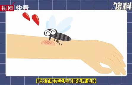 被蚊子叮咬后會(huì)越撓越癢嗎？