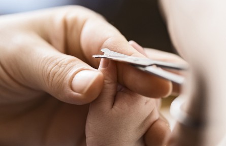 指甲長倒刺是缺少維生素？