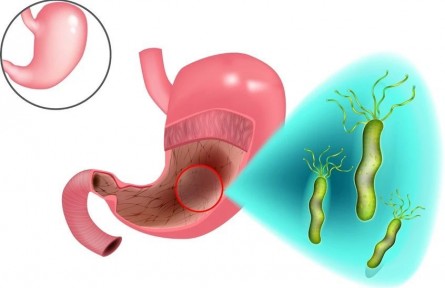 守“胃”健康，這些護胃措施請收好