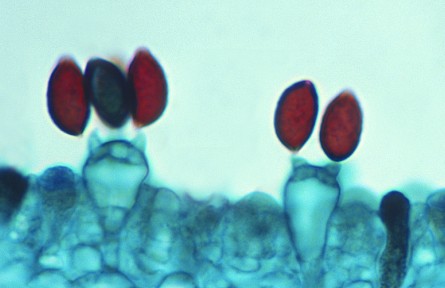 科技名詞|芽孢 spore，gemma