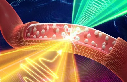 太赫茲+聲波！我國科學(xué)家使無針血鈉檢測成為可能